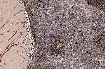 Karakoram schist